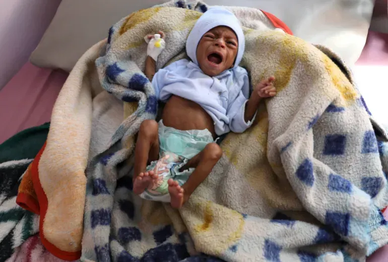 Miris! Krisis Kemanusiaan di Yaman Memburuk